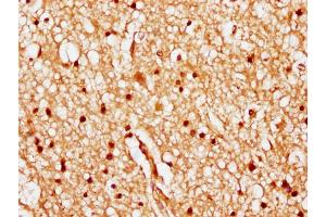 IHC image of nhibHU diluted at 1:20 and staining in paraffin-embedded human brain tissue performed on a Leica BondTM system. (HIST1H1C 抗体  (AA 82-94))