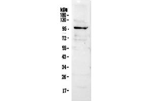 Western Blotting (WB) image for anti-Nuclear Factor of Activated T-Cells, Cytoplasmic, Calcineurin-Dependent 2 (NFAT1) (AA 594-676) antibody (ABIN5519044)