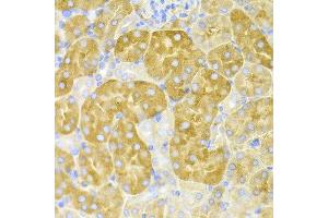 Immunohistochemistry of paraffin-embedded mouse kidney using CBS antibody at dilution of 1:100 (x400 lens). (CBS 抗体)
