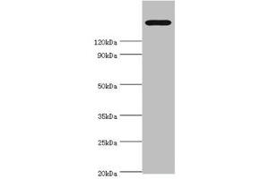 Western Blotting (WB) image for anti-Transient Receptor Potential Cation Channel, Subfamily M, Member 2 (TRPM2) (AA 1204-1503) antibody (ABIN7172857)