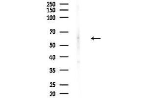 anti-F-Box Protein 7 (FBXO7) (C-Term) antibody