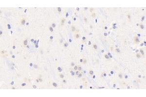 Detection of MyD88 in Rat Cerebrum Tissue using Polyclonal Antibody to Myeloid Differentiation Factor 88 (MyD88) (MYD88 抗体  (AA 1-296))