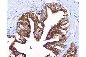 IHC analysis of PAP/ACP3 using anti-PAP/ACP3 antibody (ABIN7600122). (ACPP 抗体  (AA 150-386))