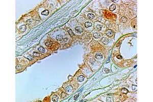 Immunohistochemistry (IHC) image for anti-Prostaglandin E Receptor 1 (Subtype EP1), 42kDa (PTGER1) (Internal Region) antibody (ABIN185589)