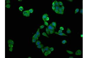 Immunofluorescence staining of PC-3 cells with ABIN7146892 at 1:133, counter-stained with DAPI. (CSNK2A2 抗体  (AA 8-350))