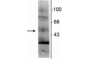 Western blot of rat hippocampal lysate showing specific immunolabeling of the ~48 kDa RXR-γ isotype. (Retinoid X Receptor gamma 抗体)