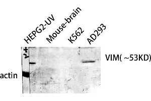 Western Blot (WB) analysis of HepG2-UV Mouse Brain AD293 K562 cells using VIM Polyclonal Antibody. (Vimentin 抗体  (C-Term))