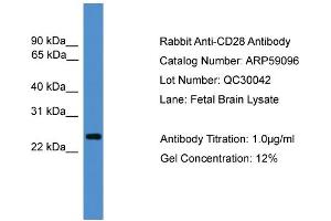 WB Suggested Anti-CD28  Antibody Titration: 0. (CD28 抗体  (C-Term))