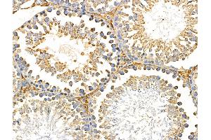 ABIN6259310 and ABIN6274936 at 1/100 staining Rat testis tissue by IHC-P. (PNPLA8 抗体  (C-Term))