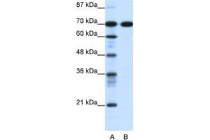 Human Jurkat; WB Suggested Anti-RRN3 Antibody Titration: 0. (RRN3 抗体  (C-Term))