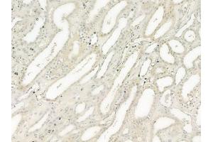 ABIN6259777 and ABIN6277561 at 1/100 staining human normal kidney tissue by IHC-P. (ADAM9 抗体  (C-Term))