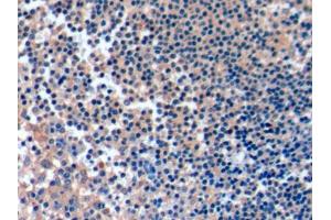 DAB staining on IHC-P; Samples: Human Tonsil Tissue (ICOSLG 抗体  (AA 23-249))