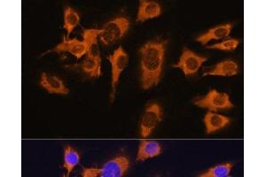 Immunofluorescence analysis of C6 cells using SLC20A1 Polyclonal Antibody at dilution of 1:100. (SLC20A1 抗体)