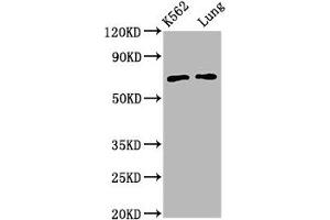 Western Blot Positive WB detected in: K562 whole cell lysate, Rat lung tissue All lanes: POF1B antibody at 3. (POF1B 抗体  (AA 532-589))