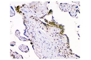 IHC analysis of HAUSP/USP7 using anti-HAUSP/USP7 antibody (ABIN6719603).