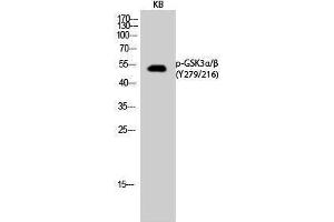 Western Blotting (WB) image for anti-Glycogen Synthase Kinase 3 alpha/beta (GSK3a/b) (pTyr216), (pTyr279) antibody (ABIN3182022) (GSK3 alpha/beta 抗体  (pTyr216, pTyr279))