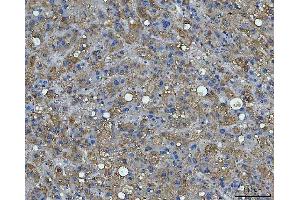 IHC analysis of BI-1/TMBIM6 using anti-BI-1/TMBIM6 antibody (ABIN7603199). (Bax Inhibitor 1 抗体  (N-Term))