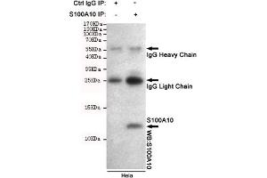 Immunoprecipitation analysis of Hela cell lysates using S100A10 mouse mAb. (S100A10 抗体)