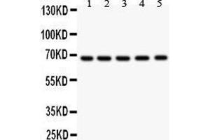 Anti- HNF1 antibody, Western blotting All lanes: Anti HNF1  at 0. (HNF1A 抗体  (AA 431-631))