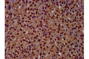 IHC image of ABIN7144968 diluted at 1:500 and staining in paraffin-embedded human adrenal gland tissue performed on a Leica BondTM system. (RECQL4 抗体  (AA 200-337))