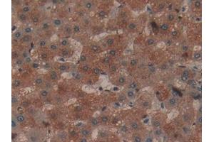 Immunohistochemistry (IHC) image for anti-Collagen, Type I, alpha 1 (COL1A1) (AA 253-471) antibody (ABIN7443395)