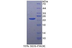 SDS-PAGE analysis of Rabbit MMP12 Protein. (MMP12 蛋白)