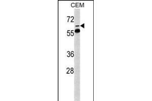 Western blot analysis of FKBP10 Antibody (N-term) (ABIN391572 and ABIN2841509) in CEM cell line lysates (35 μg/lane). (FKBP10 抗体  (AA 57-87))