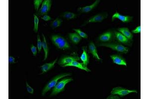 Immunofluorescent analysis of Hela cells using ABIN7168526 at dilution of 1:100 and Alexa Fluor 488-congugated AffiniPure Goat Anti-Rabbit IgG(H+L)