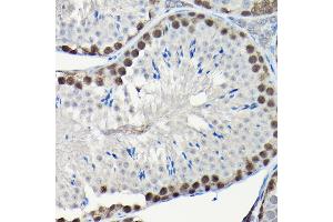 Immunohistochemistry of paraffin-embedded human placenta using Integrin alpha V (ITGAV/CD51) Rabbit mAb (ABIN7267922) at dilution of 1:100 (40x lens). (CD51 抗体)