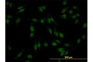 Immunofluorescence of monoclonal antibody to SMAD4 on HeLa cell. (SMAD4 抗体  (AA 1-552))