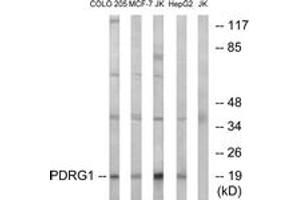 Western blot analysis of extracts from Jurkat/COLO/MCF-7/HepG2 cells, using PDRG1 Antibody.