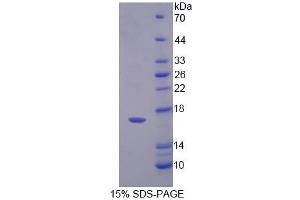 SDS-PAGE analysis of Human PFN4 Protein. (Profilin 4 Protein (PFN4))