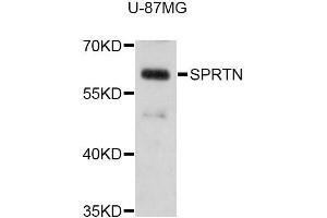 Western blot analysis of extracts of U-87MG cells, using SPRTN Antibody (ABIN5998940) at 1:3000 dilution. (Spartan 抗体)