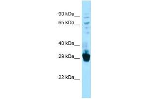 Host: Rabbit Target Name: Fibcd1 Sample Type: Mouse Lung lysates Antibody Dilution: 1.