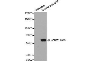 Western blot analysis of extracts from A431 cells using Phospho-CARM1-S228 antibody. (CARM1 抗体  (pSer228))