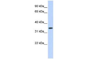 WB Suggested Anti-TRIM27 Antibody Titration:  0. (TRIM27 抗体  (Middle Region))