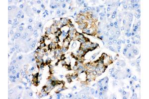 Anti- BAG2 Picoband antibody,IHC(P) IHC(P): Human Pancreatic Cancer Tissue (BAG2 抗体  (AA 1-211))