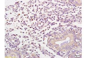 Immunohistochemistry (Paraffin-embedded Sections) (IHC (p)) image for anti-Neutrophil Cytosol Factor 1 (NCF1) (AA 151-250) antibody (ABIN750643)