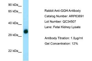 Western Blotting (WB) image for anti-gamma-Glutamyl Hydrolase (Conjugase, Folylpolygammaglutamyl Hydrolase) (GGH) (C-Term) antibody (ABIN2789590) (GGH 抗体  (C-Term))