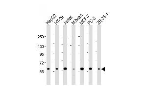 Western Blot at 1:2000 dilution Lane 1: HepG2 whole cell lysate Lane 2: HT-29 whole cell lysate Lane 3: Jurkat whole cell lysate Lane 4: mouse heart lysate Lane 5: MCF-7 whole cell lysate Lane 5: PC-3 whole cell lysate Lane 5: ZR-75-1 whole cell lysate Lysates/proteins at 20 ug per lane. (DCLRE1C 抗体  (N-Term))