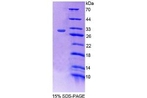 SDS-PAGE analysis of Mouse PCCb Protein. (PCCB 蛋白)