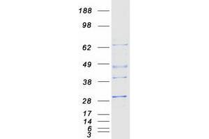Western Blotting (WB) image for Proteasome (Prosome, Macropain) Subunit, beta Type, 4 (PSMB4) protein (Myc-DYKDDDDK Tag) (ABIN2729933)
