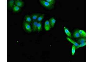 Immunofluorescent analysis of HepG2 cells using ABIN7167270 at dilution of 1:100 and Alexa Fluor 488-congugated AffiniPure Goat Anti-Rabbit IgG(H+L) (RAB27A 抗体  (AA 2-221))