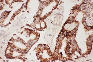 Immunohistochemistry (IHC) image for anti-Ciliary Neurotrophic Factor (CNTF) (AA 2-200) antibody (ABIN3042520)