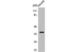 Western Blot analysis of HeLa cells using Olfactory receptor 52E5 Polyclonal Antibody (OR52E5 抗体  (Internal Region))