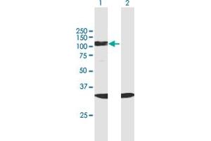 Western Blot analysis of SF3B2 expression in transfected 293T cell line by SF3B2 MaxPab polyclonal antibody. (SF3B2 抗体  (AA 1-636))