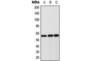 Western blot analysis of Cytokeratin 8 expression in DLD (A), mouse muscle (B), rat muscle (C) whole cell lysates. (KRT8 抗体  (Center))