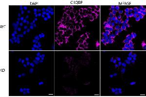 Immunocytochemical staining of HeLa cells using C1QBP antibody (ABIN7798136), 1:1,000), Top panel: wild-type (WT), Bottom panal: C1QBP shRNA knockdown (KD). (Recombinant C1QBP 抗体)