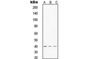 Western blot analysis of TIN2 expression in MCF7 (A), HeLa (B), Jurkat (C) whole cell lysates. (TINF2 抗体  (Center))