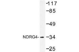 Image no. 1 for anti-NDRG Family Member 4 (NDRG4) antibody (ABIN317933) (NDRG4 抗体)